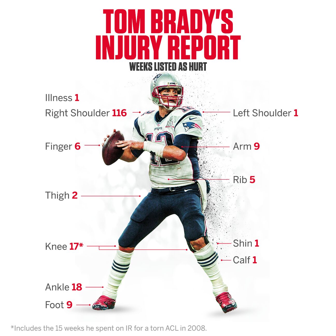 Tom Brady